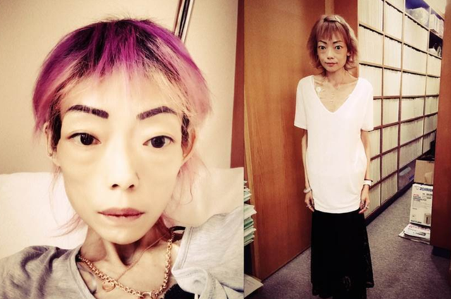 港星\最强恋爱脑\：为挽留丈夫暴瘦到44斤，牙齿掉光，仙女变骷髅