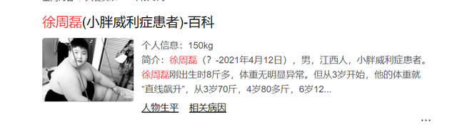 14岁男孩体重300斤！3岁就能吃半缸米饭，生前一个习惯非常不好