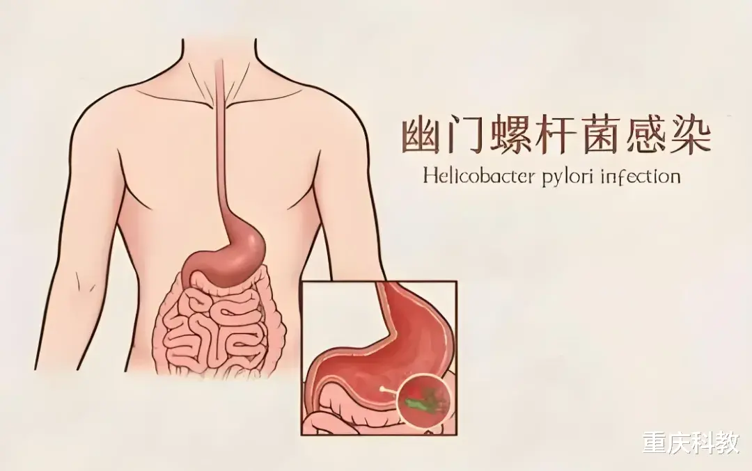 胃“喜欢”的7种水果，日常可多吃，修复胃黏膜，养胃又护胃