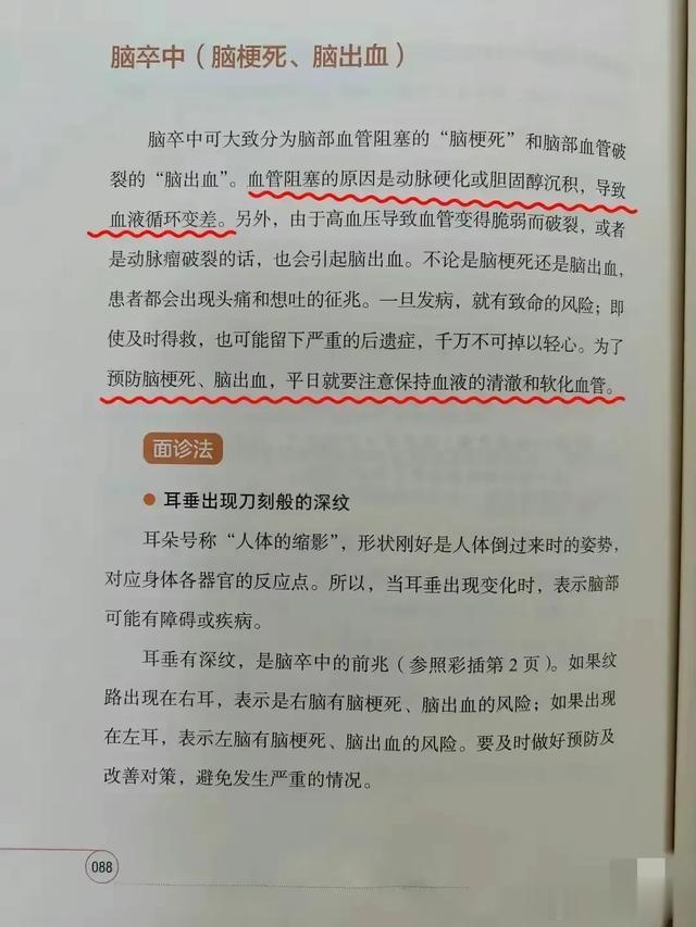 耳垂纹路深，脑卒中风险高？专家解读血脂异常现象！
