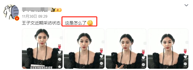 我的天，她也去整容了?