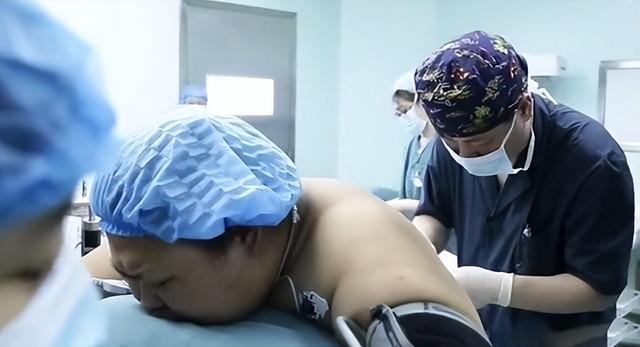 2017年，320斤重的女子舍命产子，医生扒开脂肪层抱出7斤重的男婴