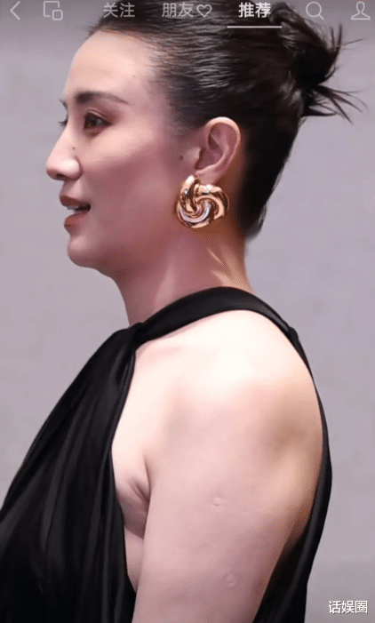 宋佳参加活动生图曝光!肩膀种花花痕迹明显,身材丰腴人高马大