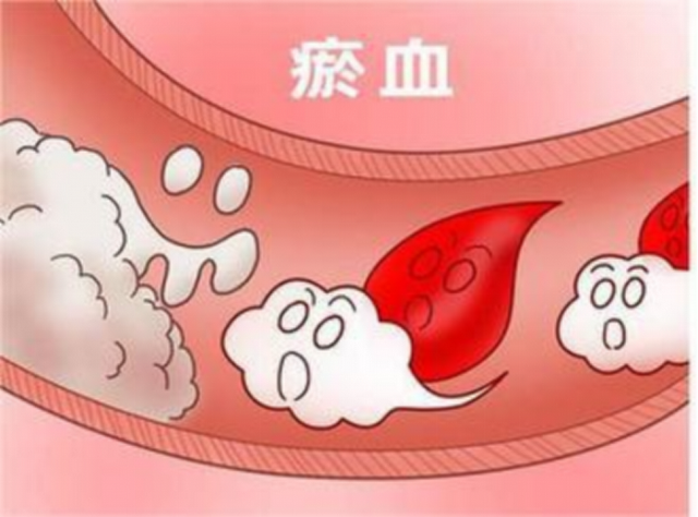 中医:只要出现前列腺炎,牢记一清二通三补 护好生命腺 关键不掉链