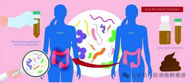 案例：肠菌移植不仅迅速改善肥胖，还同时改善脂肪肝、血脂、血压