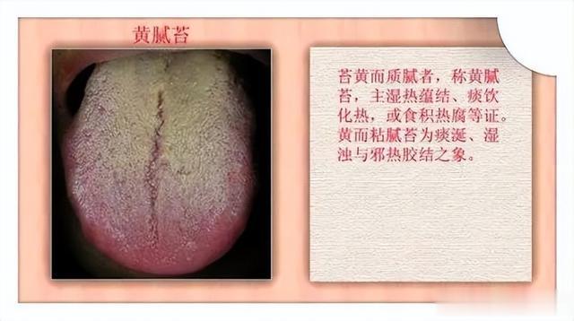 越来越热，散结最佳期！?凡寒湿重必有4淤，通4穴，防各种结节！