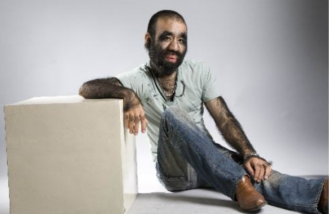 毛孩于震寰42岁娶美娇妻，不顾阻拦冒险生娃，儿子长相出人意料！