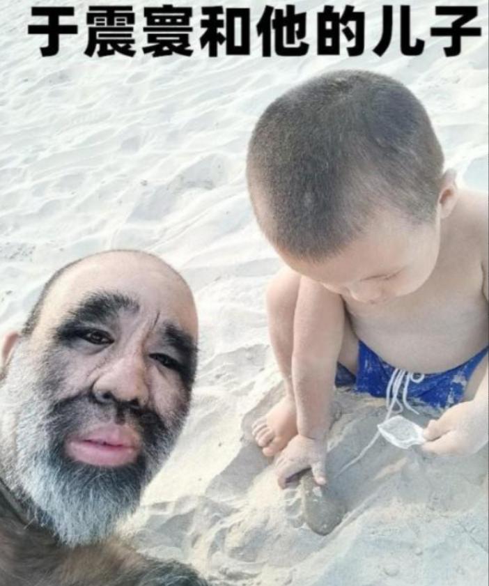 当年轰动一时的“毛孩”：42岁娶90后小娇妻，生一子有无遗传？