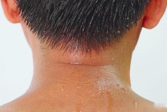 头颈部老是汗津津，头发经常湿漉漉，身体哪儿出问题了？中医解惑