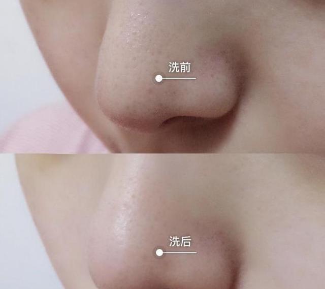 马上停止用这种洁面乳,有毒、伤皮肤!全家遭殃!