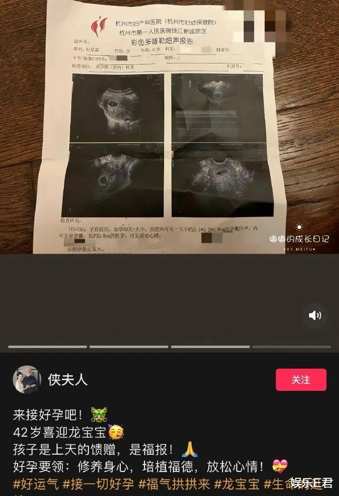 73岁张纪中再度当爸,杜星霖激动晒验孕棒,夫妻养生多年成效显著