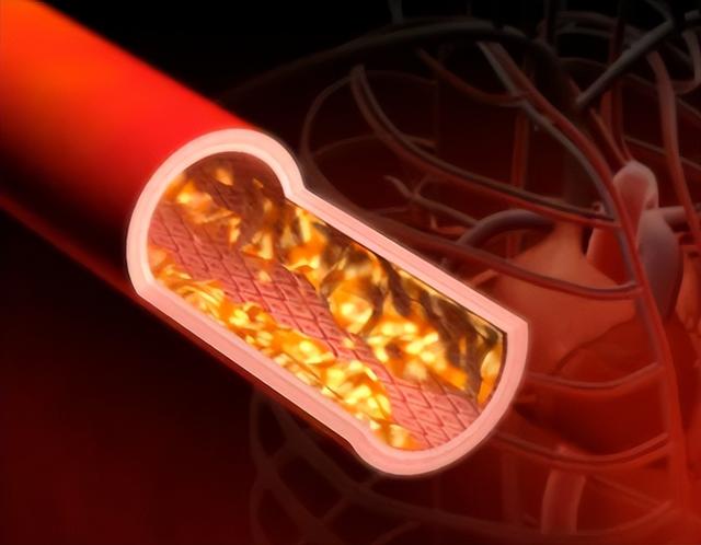 戒烟戒出一身病？可能突发心梗、脑梗？60岁以后戒烟到底好不好？
