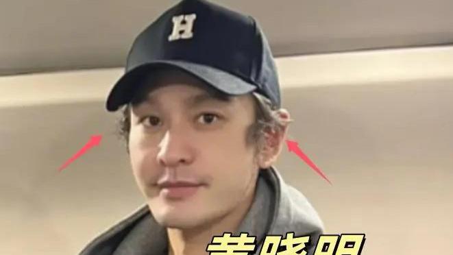 黄晓明坐高铁被偶遇，本人面相憔悴无精打采，额前无发被指已秃头