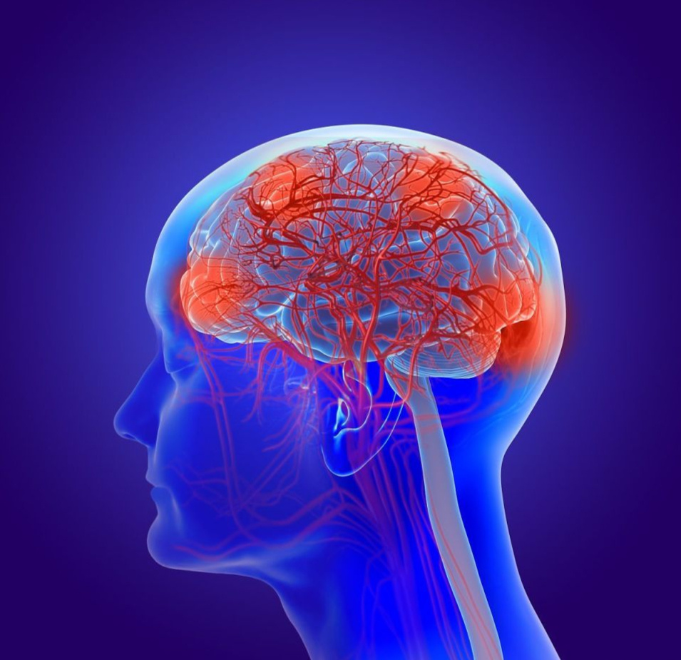 提醒:“滥用”4种调味料,或成为脑梗的祸根,望你早做了解