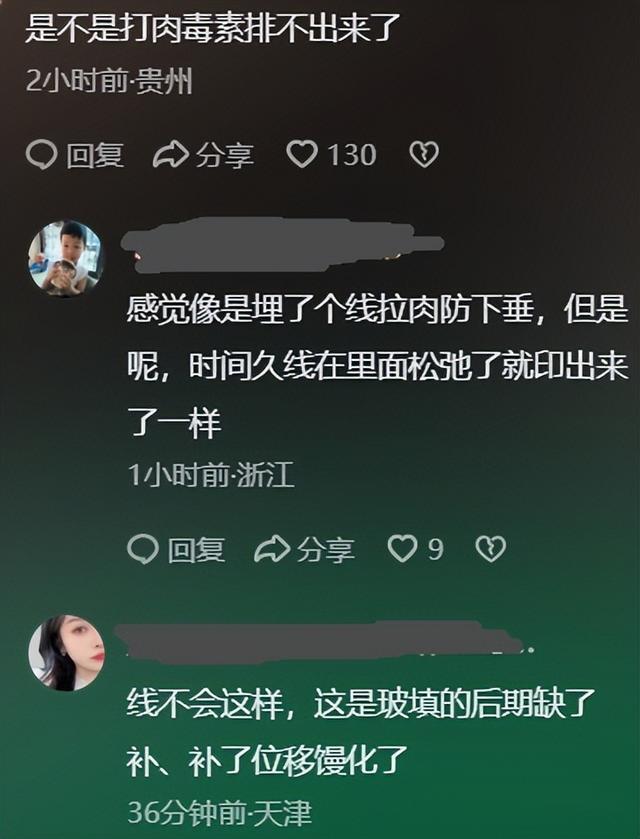 郎平脸部出现明显痕迹，疑似医美失败，直言：退休了，快乐每一天