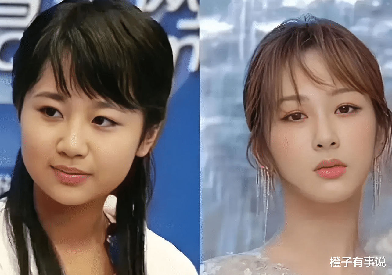 杨紫又变样了,侧面神似蔡明阿姨,网友叫她不要再去整容了