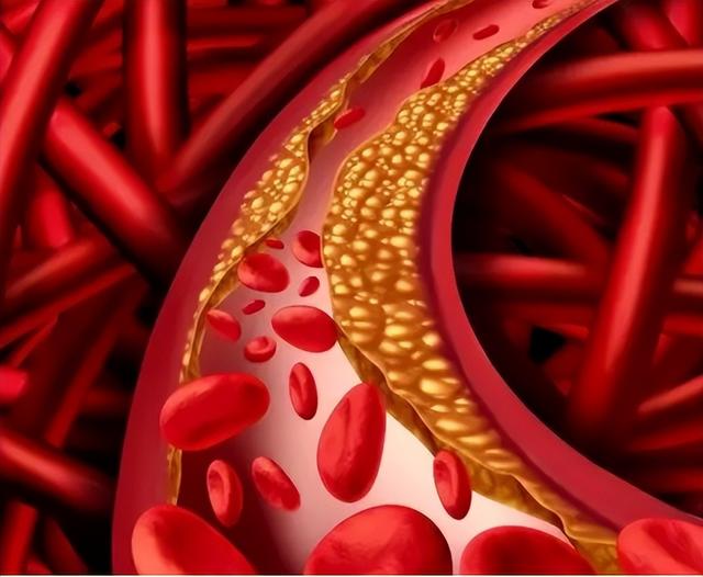 寿命比较短的男性，通常会有4个“共性”，希望你一个也不占！