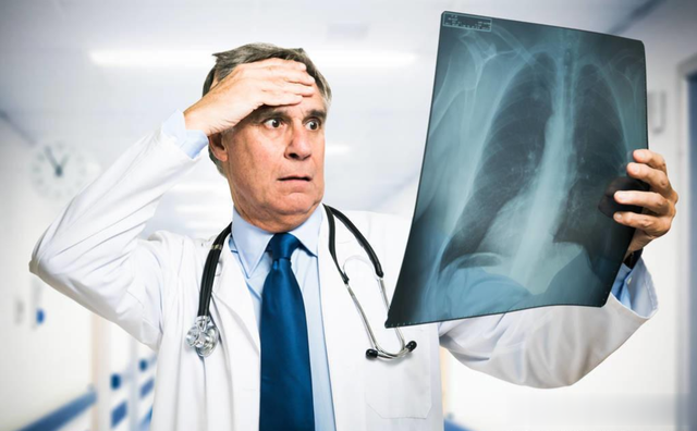 医生研究124位肺气肿患者，最后发现：会患肺气肿的人，有2个特征