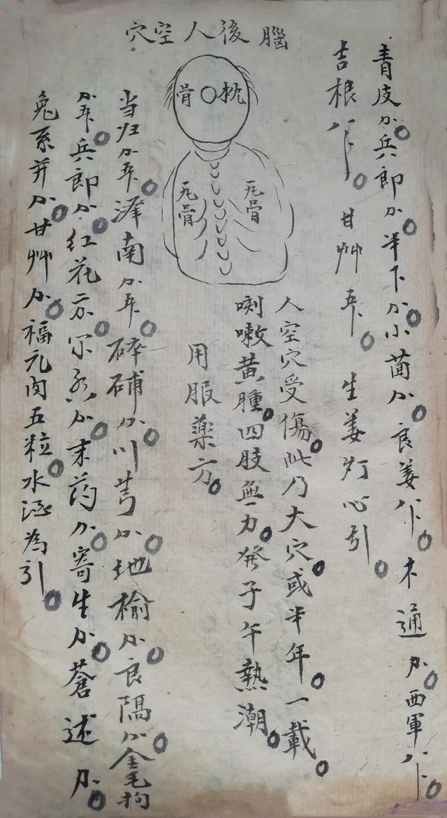 跌打损伤伤穴位秘方古书籍