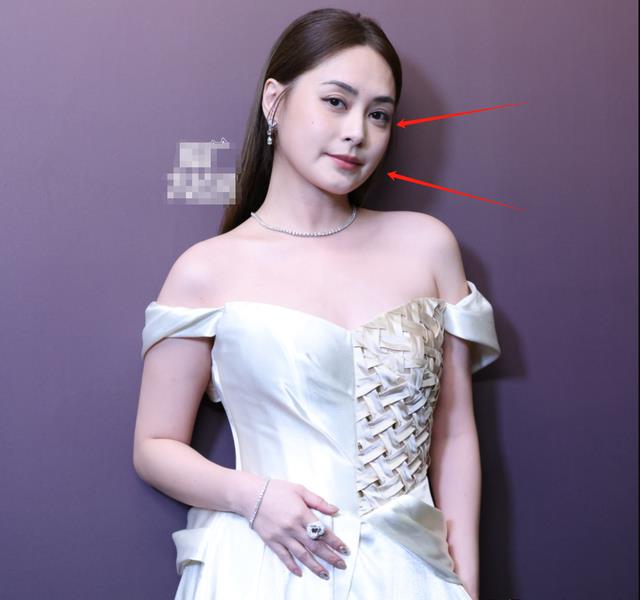 北京这几夜，蜂窝脸的秦昊，大妈脸的虞书欣，治好了我的容貌焦虑