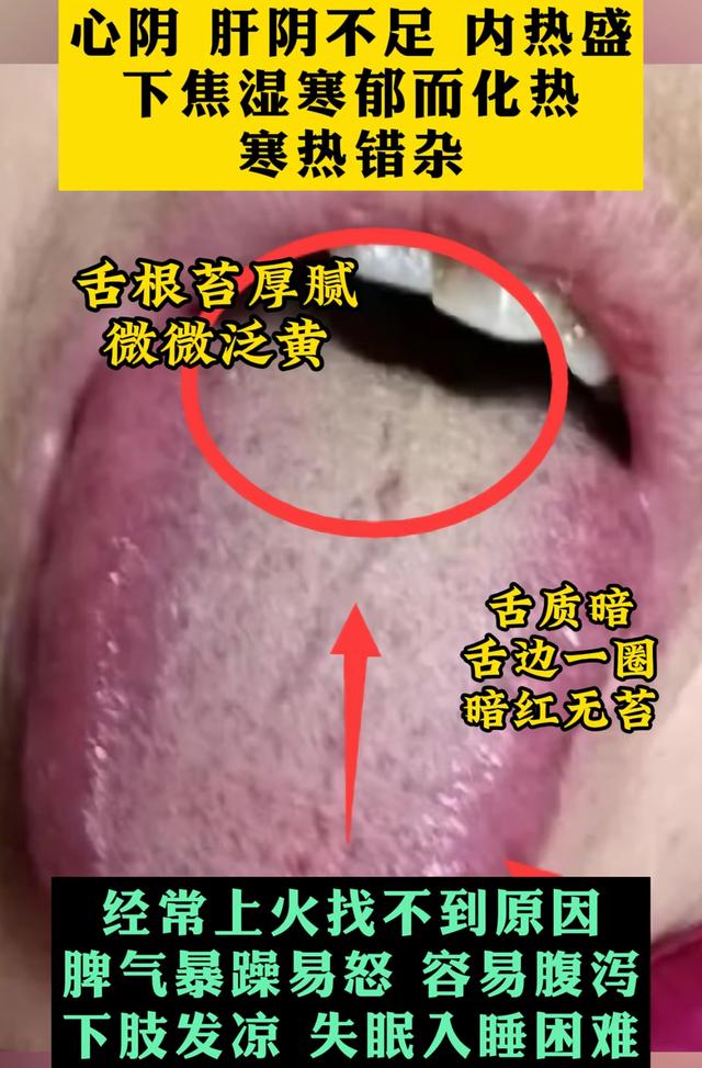 潘医生舌诊—实战分析:湿气重、肾气虚不忌嘴,把舌头造成这样!