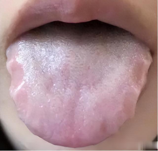 平时不吃寒的，为什么还会脾胃虚寒？其实就是这两处“火”太小了