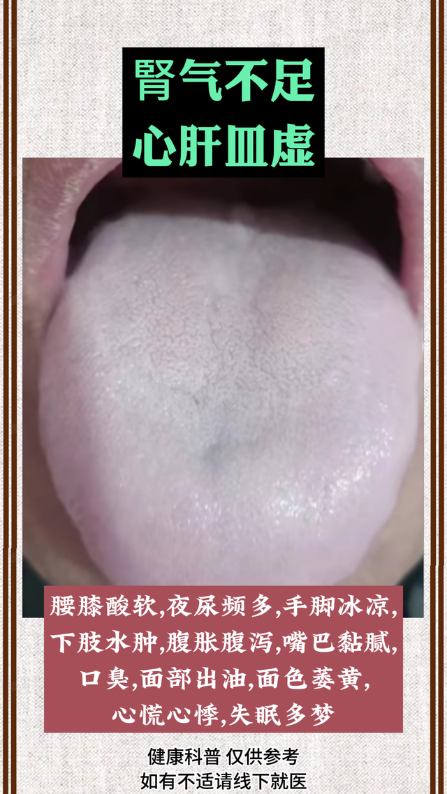 漆主任男妇科——舌诊实战经验分享：阴虚火旺，痰湿重、脾胃湿热