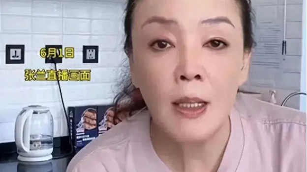 张兰承认患白癜风！4次患病的回应都是教科书式，和大S完全相反