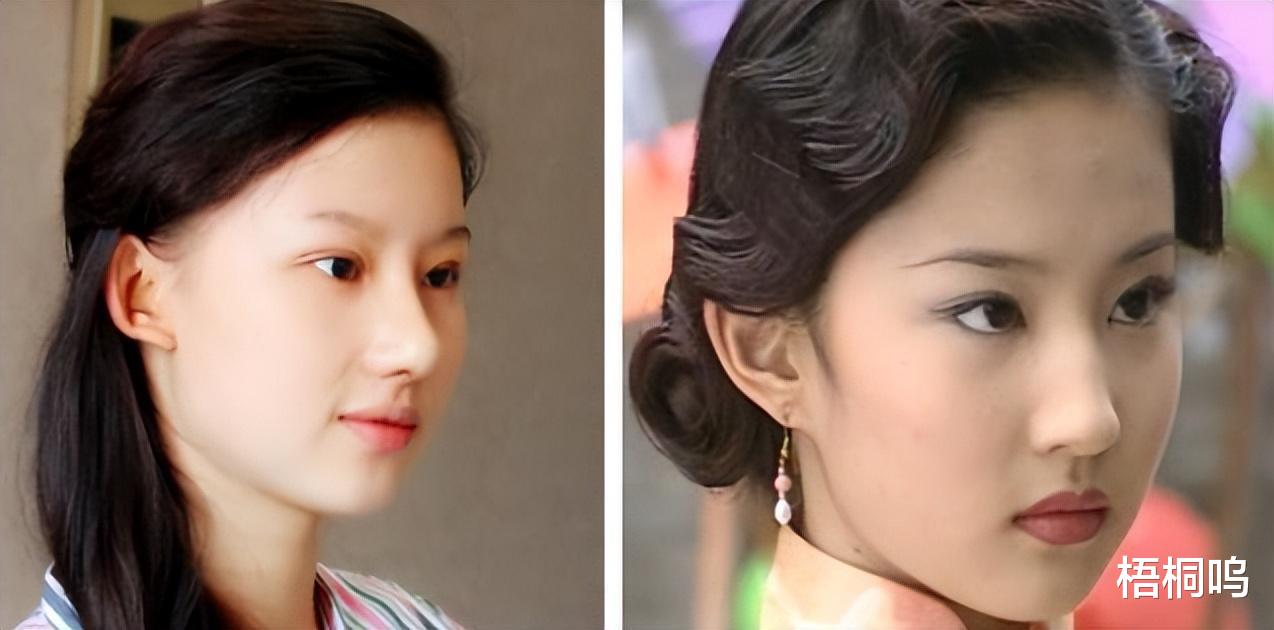 19岁少女执意整成刘亦菲,连名字也高仿,8年后却过上另一种人生