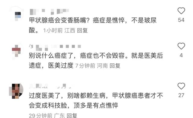 朱迅被疑整容失败大变样嘴歪脸僵撞脸宋小宝，健康状况引担忧