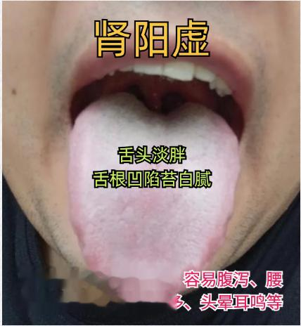 赵医生舌诊——生活中常见的五个经典舌象，看你属于哪一种？