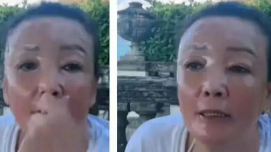 曝张兰患上白癜风状态堪忧，不想汪小菲夫妇担心，特意跑国外治疗