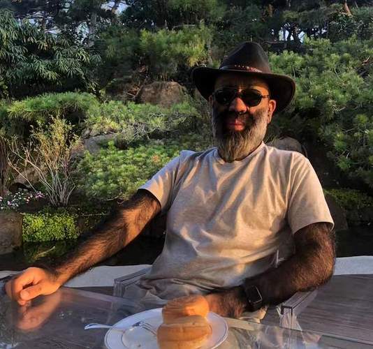 当年轰动一时的“毛孩”：42岁娶90后小娇妻，生一子有无遗传？