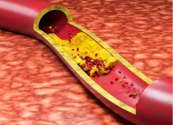 长期喝咖啡，身体最后会怎样？提醒：这3个后果，早知道早好