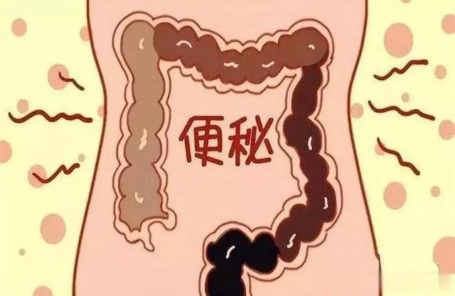 便秘病机在肝，与肠无关！
