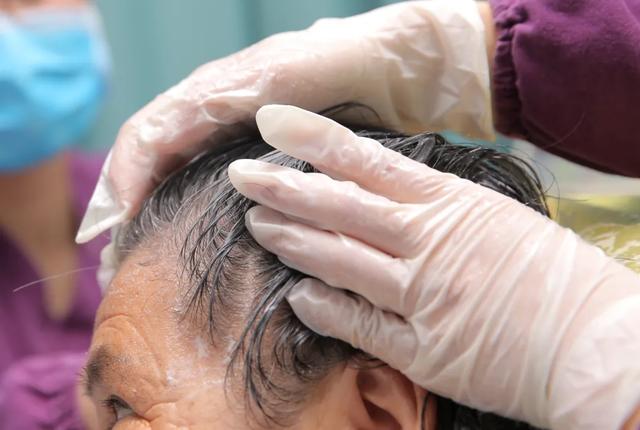 头发多久洗一次才最好?5个洗头习惯让你头发越洗越少!