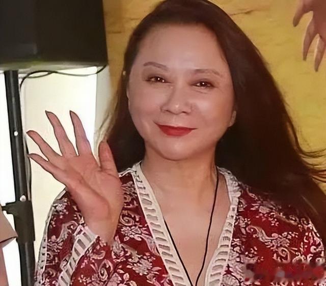 8位被整容\硅胶脸\害惨的好演员,蔡明脸肿嘴歪,刘晓庆笑不出来