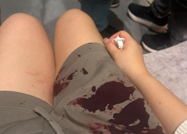 香港女星宣布小产!爱犬被山狗咬伤悲痛欲绝:孕9周胎儿没了心跳