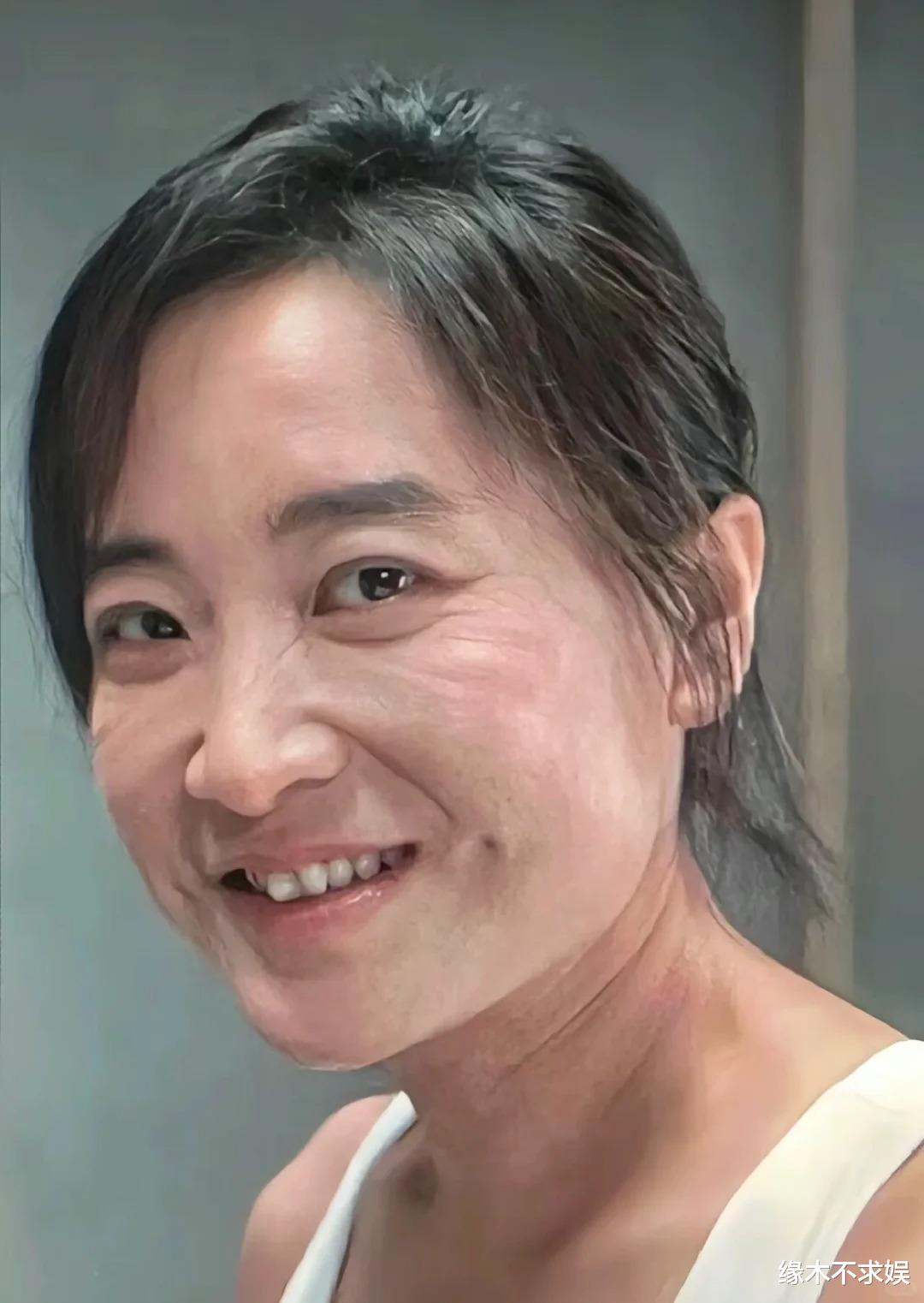 36岁林更新被偶遇，瘦到脱相认不出，腿上全是伤显病态！