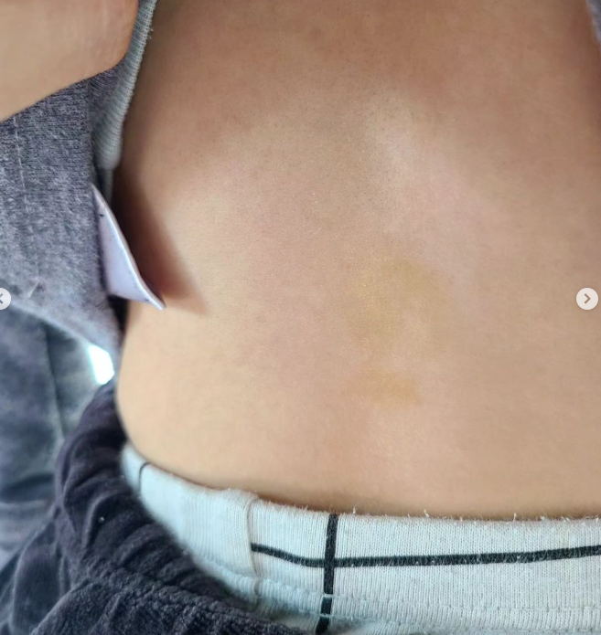 韩女星李雅凛家中自杀获救但昏迷不醒，曾多次控诉前夫家暴