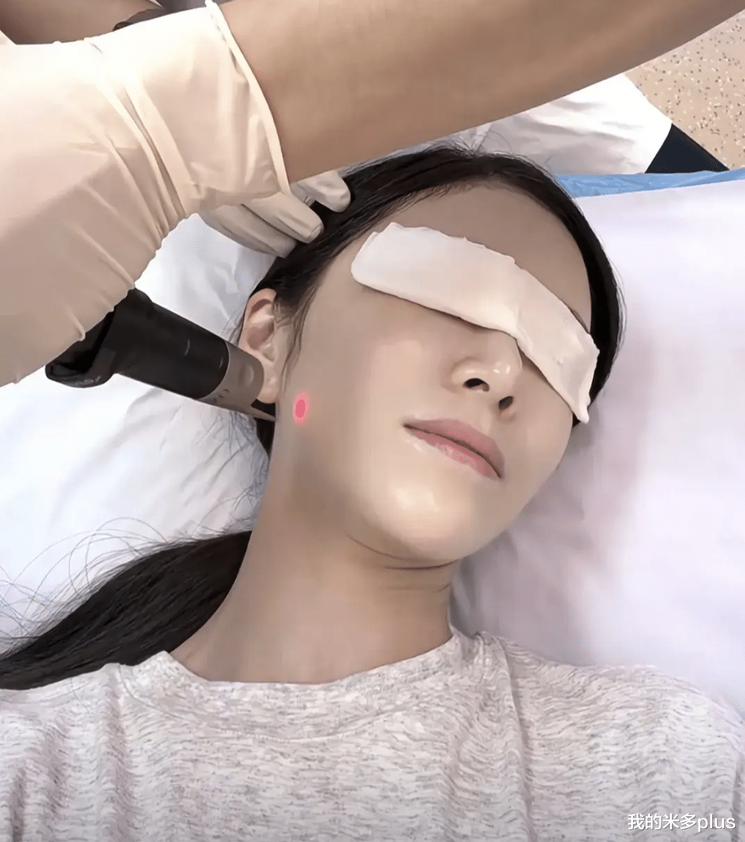 杜淳老婆晒美容过程,王灿力证自己没do脸:鼻子是真的,没有科技