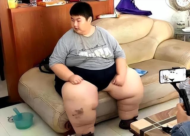 14岁男孩体重300斤！3岁就能吃半缸米饭，生前一个习惯非常不好