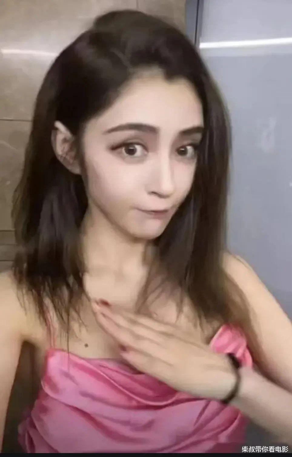 “内卷”下暴瘦的10位女星，有人瘦到22公斤，体力不支只能坐轮椅