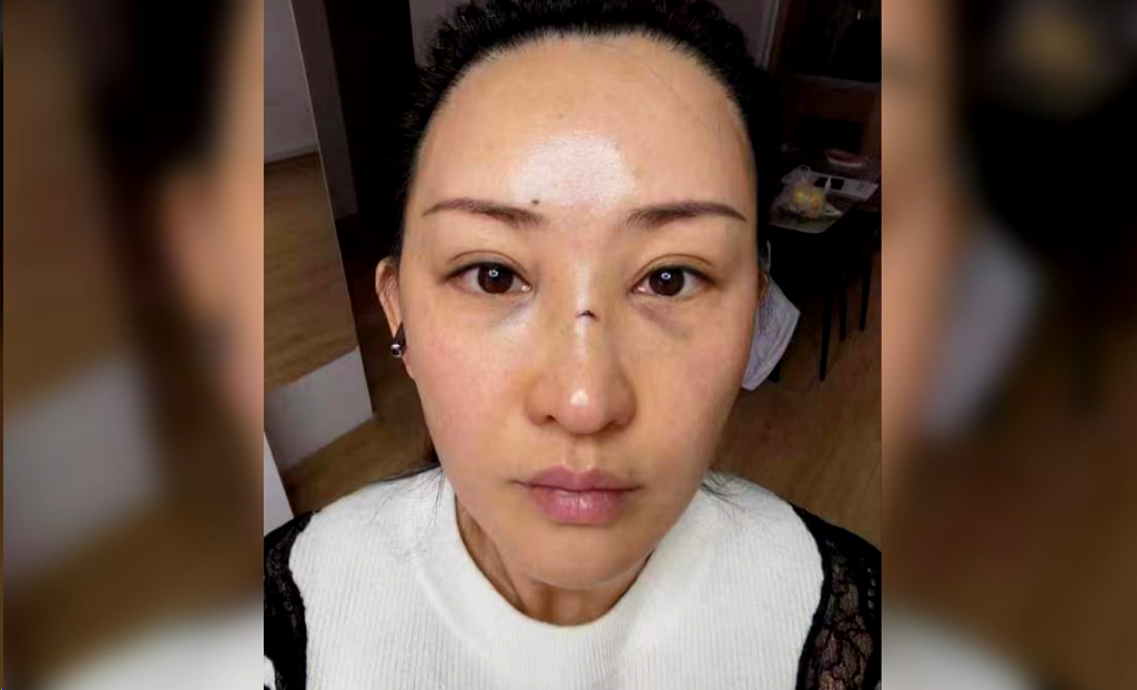 女子健身时，几十斤重的健身器材砸在脸上……