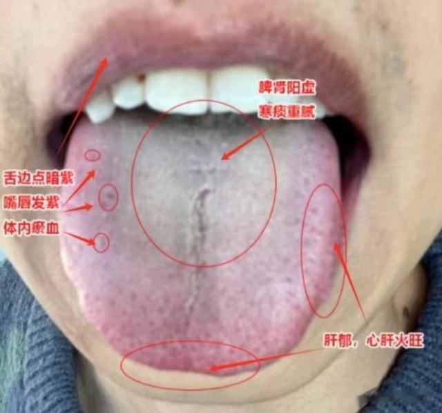 临床常见的舌象,大部分都是这几个原因,找好对症,调理很简单