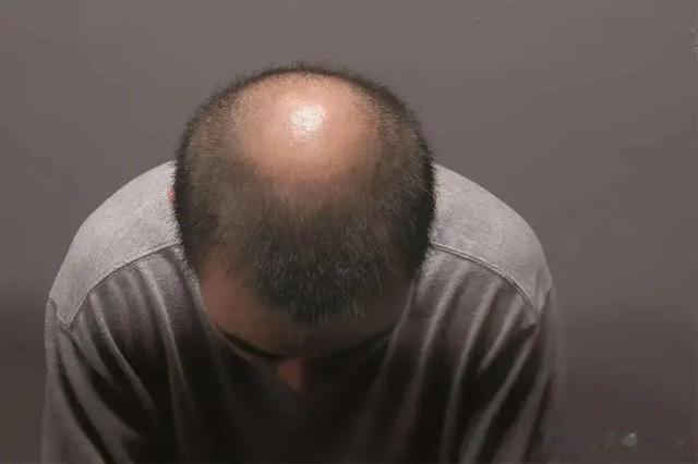 1个中成药，强过“他达拉非”，堪称肝肾全能王，还可调理这4种病