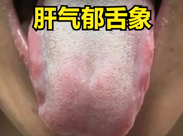 宗筋不坚，除了肾，更重要的在肝！