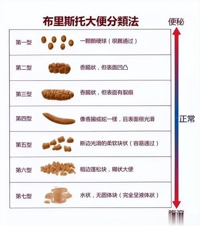 什么样的大便，意味着肠癌？什么样的才是正常的？