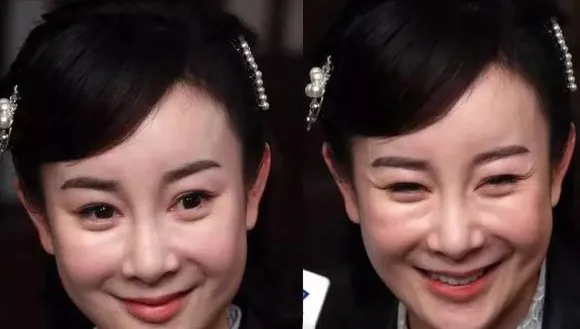 我的天，她也去整容了?