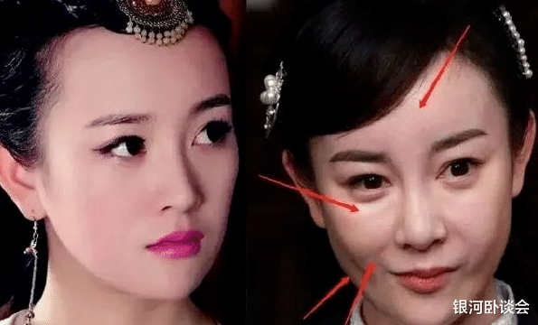 我的天,她也整容了?